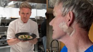 Celebrity Chef Gordon Ramsay Ki Skin Cancer Surgery Successful