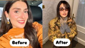 Ayeza Khan Ki Cosmetic Surgery Ne Social Media Par Behas Chher Di