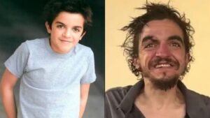 Sark Par Lawaaris Milne Wale Former Child Star Ka Ilaaj Karwane Se Inkaar